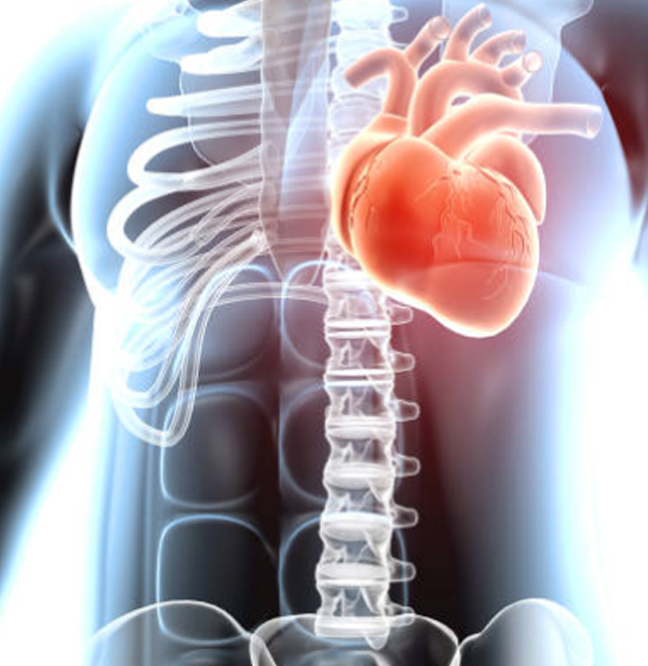 Cardiólogo Intervencionista