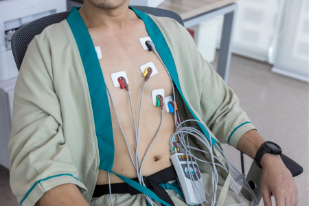 Electrocardiograma